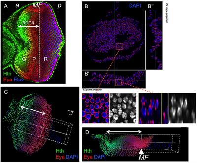 A Toggle-Switch and a Feed-Forward Loop Engage in the Control of the Drosophila Retinal Determination Gene Network